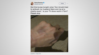 Roma Downy Injured During a Brawl Between Tom Arnold and Mark Burnett at an Emmys Party